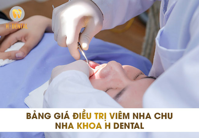 Điều trị nha chu 1 răng có giá khoảng 1 triệu đồng tại nha khoa H Dental