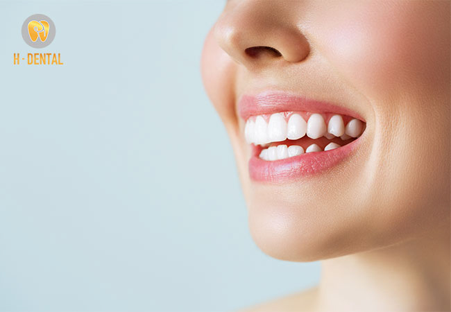 Niềng răng làm cho răng đẹp và bạn sẽ tự tin hơn khi nói chuyện với người khác