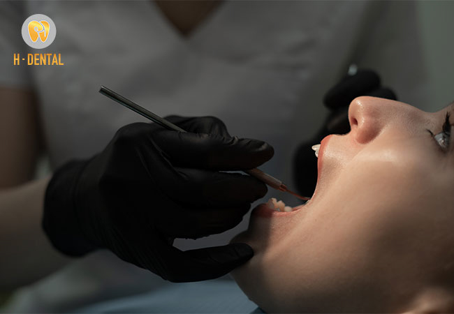 Dán sứ veneer là một bước cải tiến lớn trong dịch vụ thẩm mỹ răng hiện đại