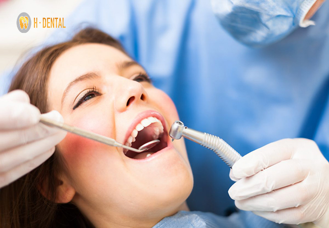 Trám răng thưa mang lại nhiều lợi ích cho răng hàm